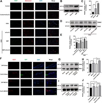 Effect of Dl-3-n-butylphthalide on mitochondrial Cox7c in models of cerebral ischemia/reperfusion injury